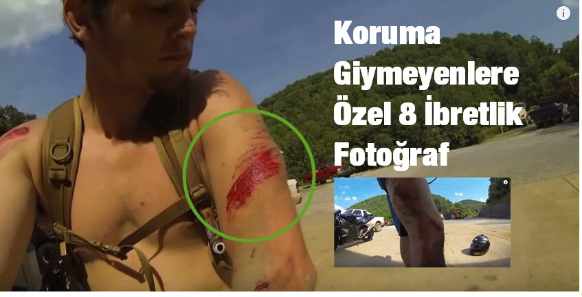 Koruma Giymeyenlere Özel 8 İbretlik Fotoğraf