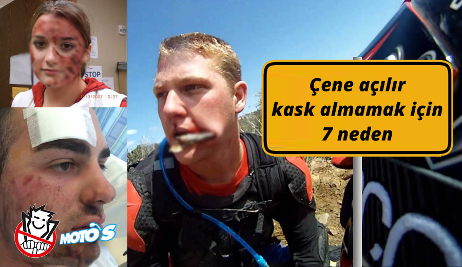 Çene açılır kask almamak için 7 neden